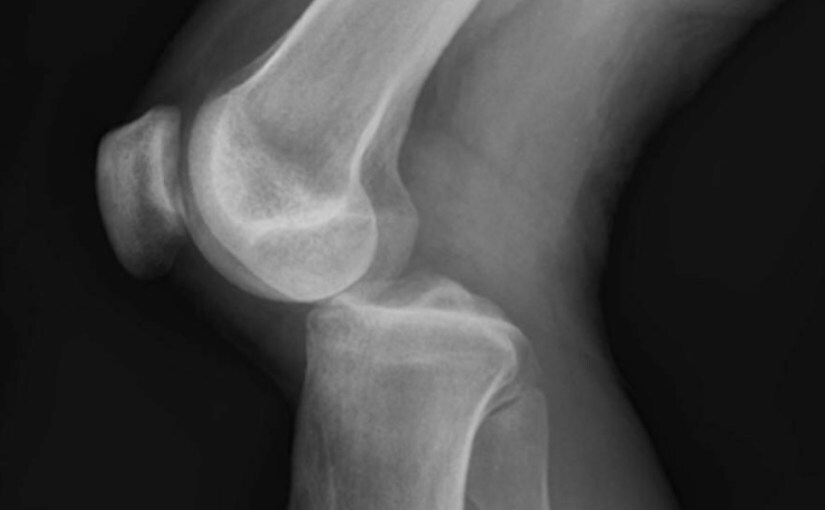 A dislocation for the Ages